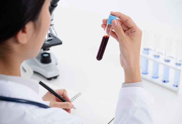 Проведение исследований крови Анализ крови